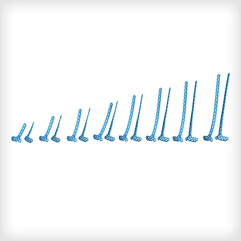 Anterolateral Distal Tibia Plates