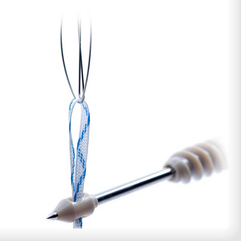 DEXLOCK KNOTLESS Suture Anchors