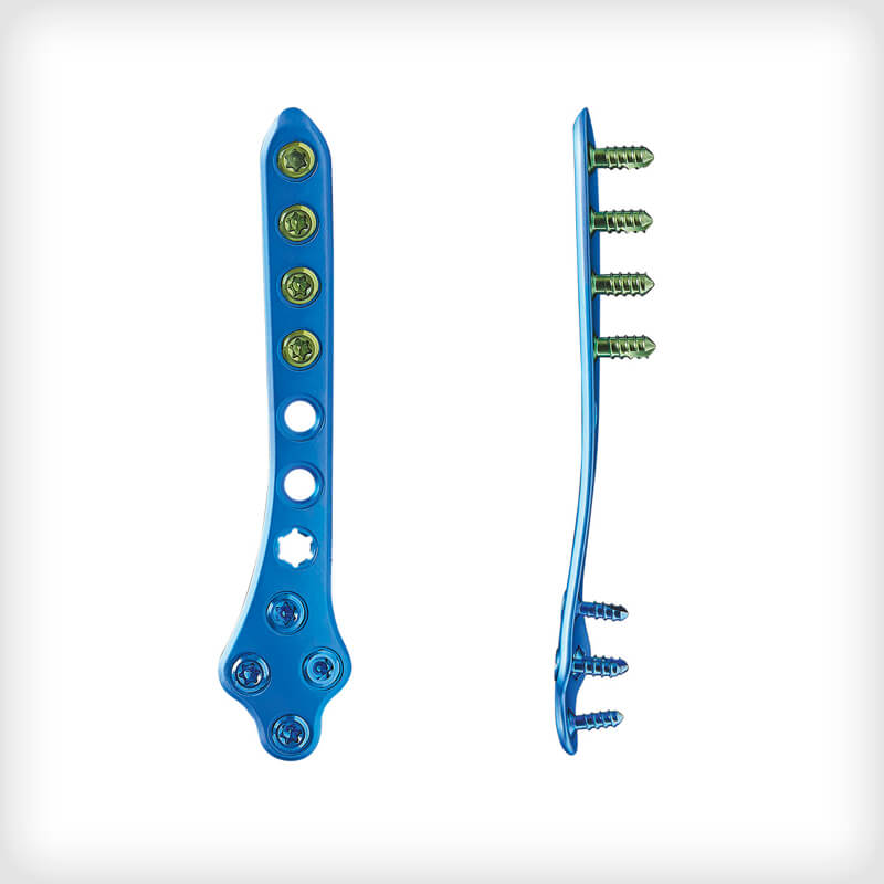 Lateral Fibula Plates