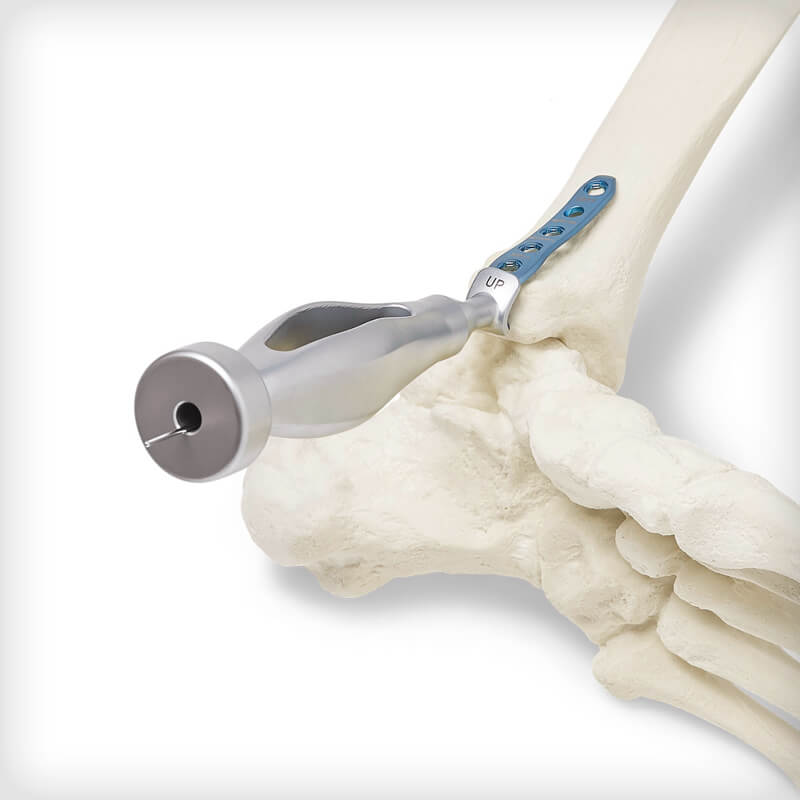 Malleolar Hook Plates