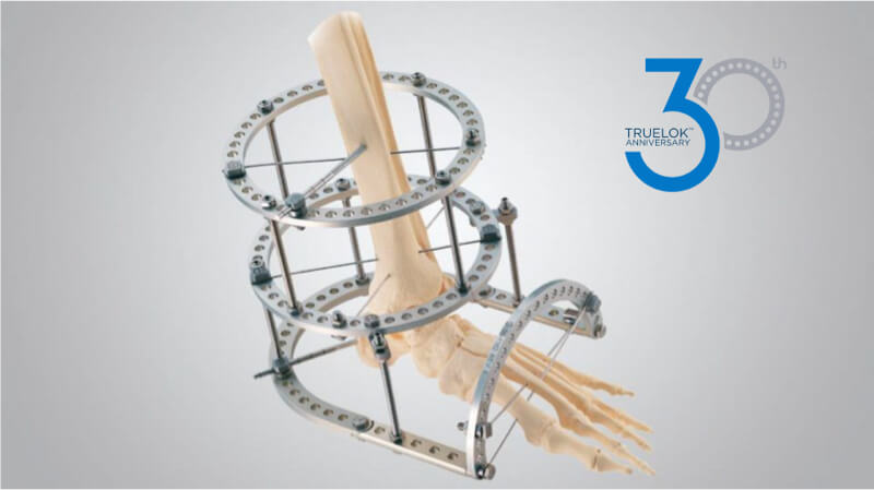 TrueLok Ring Fixation System