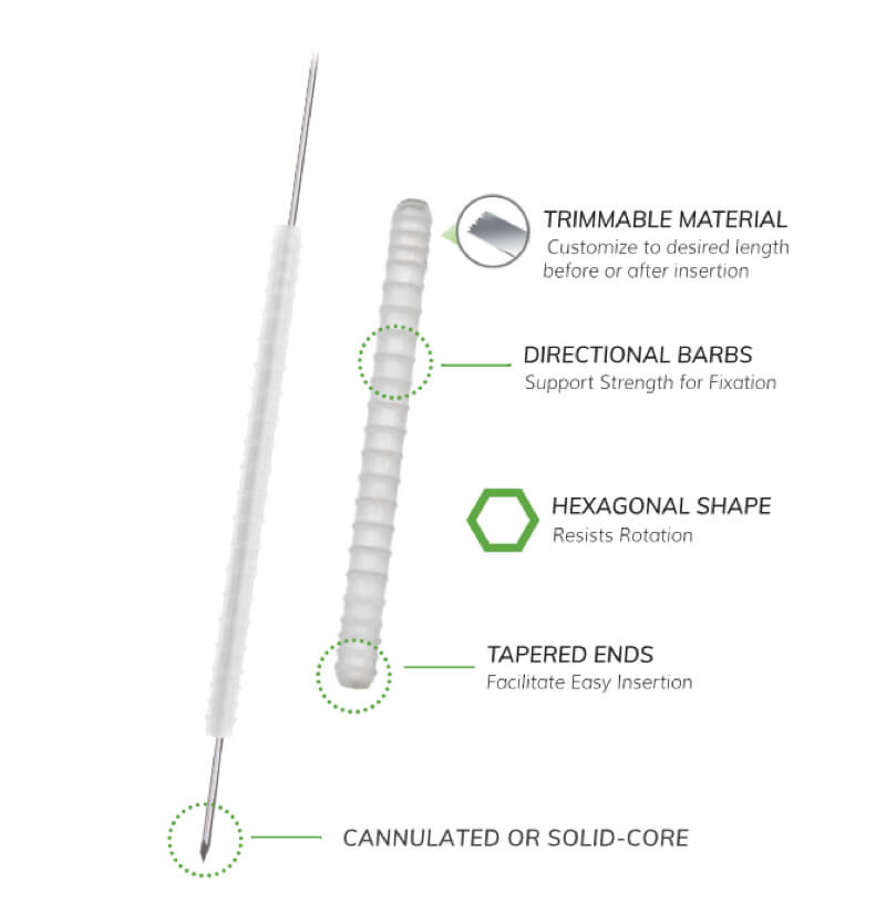 Trimmible Fixation Nails